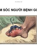 Bài giảng Chăm sóc người bệnh gout