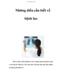 Những điều cần biết về bệnh lao