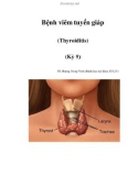 Bệnh viêm tuyến giáp (Thyroiditis) (Kỳ 5)