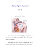 Máy tạo nhịp tim - Pacemaker (Kỳ 1)