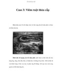 Case 3: Viêm ruột thừa cấp