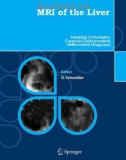 MRI of the Liver - 2nd Edition Imaging Techniques, Contrast Enhancement, Differential Diagnosis