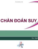 CHẨN ĐOÁN SUY TIM