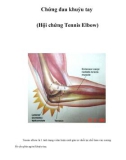 Chứng đau khuỷu tay (Hội chứng Tennis Elbow)