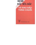 Triệu chứng Bệnh đau nửa đầu và đau đầu từng chuỗi: Phần 1