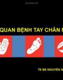 Bài giảng Tổng quan bệnh tay chân miệng