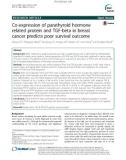 Co-expression of parathyroid hormone related protein and TGF-beta in breast cancer predicts poor survival outcome