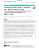 The multiple systemic artery to pulmonary artery fistulas resulting in severe irreversible pulmonary arterial hypertension in patient with previous history of pneumothorax