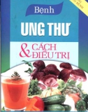 Phương pháp phòng và điều trị bệnh ung thư: Phần 1