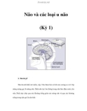 Não và các loại u não (Kỳ 1)