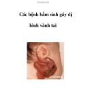 Các bệnh bẩm sinh gây dị hình vành tai