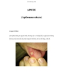 APHTE (Apthousus ulcers)