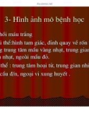 Giải phẫu bệnh - Tắc mạch ( Embolie) part 3