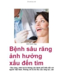 Bệnh sâu răng ảnh hưởng xấu đến tim