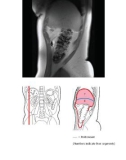 Pocket Atlas of Sectional Anatomy Computed Tomography and Magnetic Resonance Imaging - Volume II Thorax, Heart, Abdomen, and Pelvis (Part 2 )