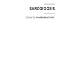 SARCOIDOSIS