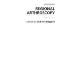 REGIONAL ARTHROSCOPY