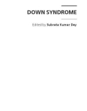 DOWN SYNDROME