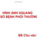 Báo cáo: Hình ảnh Xquang một số bệnh phổi thường gặp