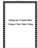 Thông tin về bệnh Đốm Trắng ở Thẻ Chân Trắng