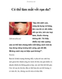 Có thể làm mất vết rạn da?