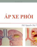 Bài giảng Áp xe phổi - ThS. Nguyễn Thị Ý Nhi