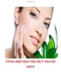 Tổng hợp mẹo trị mụn nhanh nhất