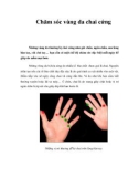 Chăm sóc vùng da chai cứng