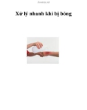 Xử lý nhanh khi bị bỏng