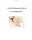 Các biến chứng nguy hiểm của xơ vữa động mạch