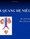 X quang hệ niệu