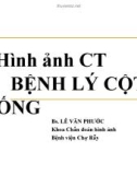 Bài giảng Hình ảnh CT bệnh lý cột sống - BS. Lê Văn Phước (54tr)