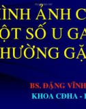 HÌNH ẢNH CT MỘT SỐ U GAN THƯỜNG GẶP