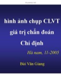 Bài giảng Hình ảnh chụp CLVT giá trị chuẩn đoán và chỉ định - Bùi Văn Giang