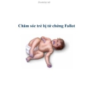 Chăm sóc trẻ bị tứ chứng Fallot