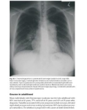 Adult Congenital Heart Disease - Part 7