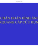 Bài giảng Chuẩn đoán hình ảnh Xquang cấp cứu bụng