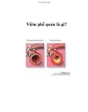 Viêm phế quản là gì?