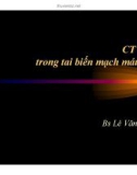 CT Scan trong tai biến mạch máu não