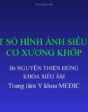 MỘT SỐ HÌNH ẢNH SIÊU ÂM CƠ XƯƠNG KHỚP