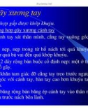 Kỹ Thuật Cố Định Tạm Thời Xương Gãy (Phần 4)