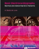 Basic Electrocardiography - NORMAL AND ABNORMAL ECG PATTERNS