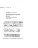 Basic Electrocardiography Normal and abnormal ECG patterns - Part 8