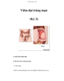 Viêm đại tràng mạn (Kỳ 3)