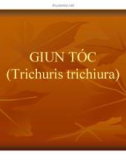 Bài giảng Giun tóc (Trichuris trichiura)