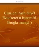 Bài giảng Giun chỉ bạch huyết (Wuchereria bancrofti Brugia malayi)