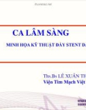 Bài giảng Ca lâm sàng minh họa kỹ thuật đẩy Stent dài - Ths. Bs. Lê Xuân Thận