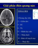 Giải phẫu thần kinh đối chiếu chẩn đoán Hình ảnh part 7