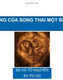 Biến chứng của song thai một bánh nhau - BS. Hà Tố Nguyên