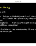 Bài giảng U đắc tụy (Phần 2)